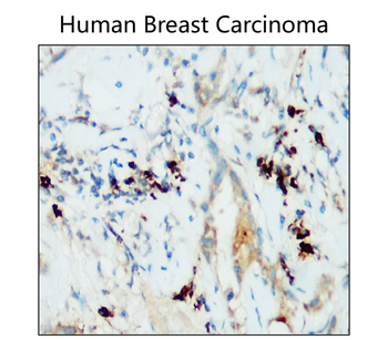 PD-L1 Rabbit Polyclonal Antibody
