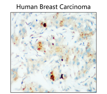 PD-L1 Rabbit Polyclonal Antibody