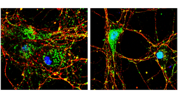 EEA1 Rabbit Polyclonal Antibody