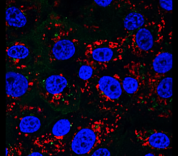EEA1 Rabbit Polyclonal Antibody