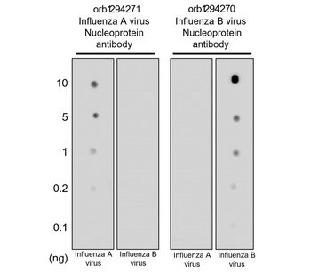 Influenza B Virus Nucleoprotein Rabbit Polyclonal Antibody