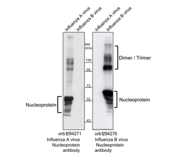 Influenza B Virus Nucleoprotein Rabbit Polyclonal Antibody
