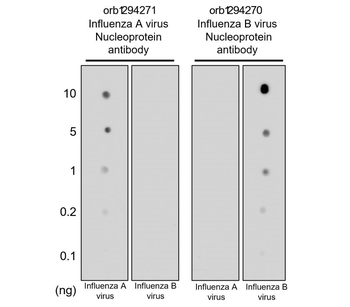 Influenza A Virus Nucleoprotein Rabbit Polyclonal Antibody