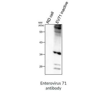 Enterovirus 71 Rabbit Polyclonal Antibody