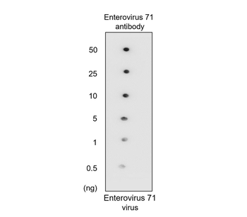 Enterovirus 71 Rabbit Polyclonal Antibody
