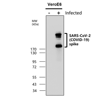 SARS-CoV-2 (COVID-19) Spike Rabbit Polyclonal Antibody