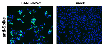 SARS-CoV-2 (COVID-19) Spike Rabbit Polyclonal Antibody
