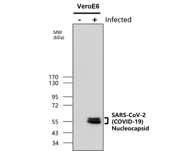 SARS-CoV-2 (COVID-19) nucleocapsid Rabbit Polyclonal Antibody