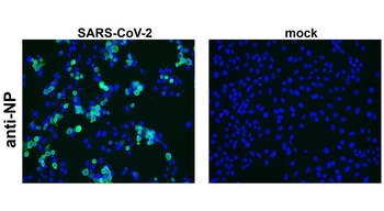SARS-CoV-2 (COVID-19) nucleocapsid Rabbit Polyclonal Antibody