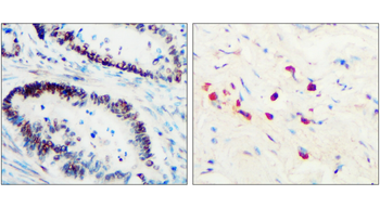 Toll-like Receptor 3 Rabbit Polyclonal Antibody
