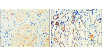ALIX Rabbit Polyclonal Antibody