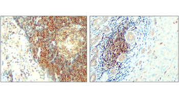 ALIX Rabbit Polyclonal Antibody