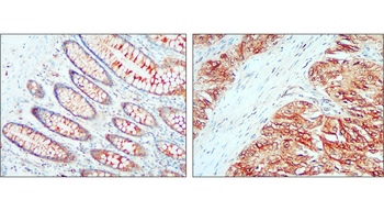 ALIX Rabbit Polyclonal Antibody