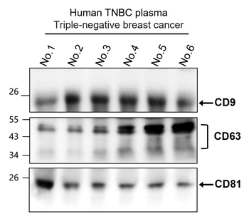 CD63 Rabbit Polyclonal Antibody