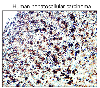 CD63 Rabbit Polyclonal Antibody