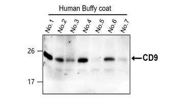 CD9 Rabbit Polyclonal Antibody