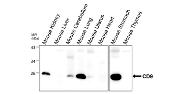CD9 Rabbit Polyclonal Antibody
