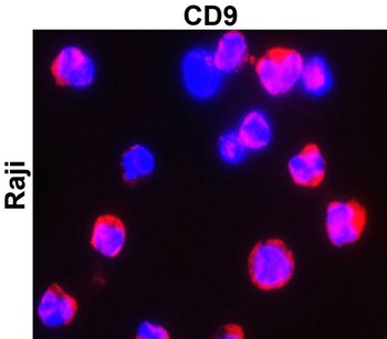 CD9 Rabbit Polyclonal Antibody