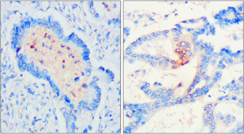 CD9 Rabbit Polyclonal Antibody