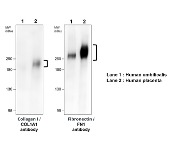 COL1A1 Rabbit Polyclonal Antibody