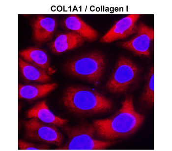 COL1A1 Rabbit Polyclonal Antibody