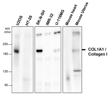 COL1A1 Rabbit Polyclonal Antibody