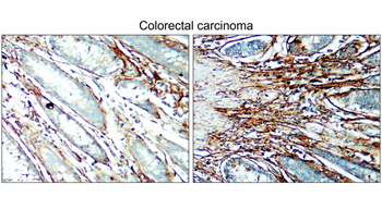 COL1A1 Rabbit Polyclonal Antibody
