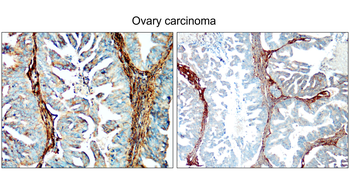 COL1A1 Rabbit Polyclonal Antibody