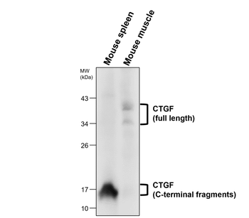 CTGF Rabbit Polyclonal Antibody