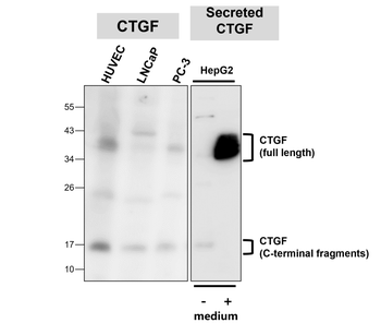 CTGF Rabbit Polyclonal Antibody