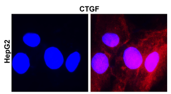 CTGF Rabbit Polyclonal Antibody