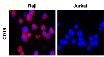 CD19 Rabbit Polyclonal Antibody