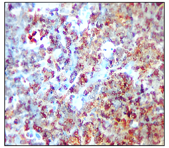 CD19 Rabbit Polyclonal Antibody