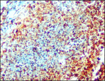 CD3 Rabbit Polyclonal Antibody