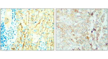 Syndecan-1 Rabbit Polyclonal Antibody