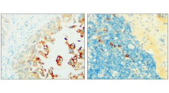 Syndecan-1 Rabbit Polyclonal Antibody