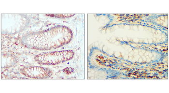 Syndecan-1 Rabbit Polyclonal Antibody