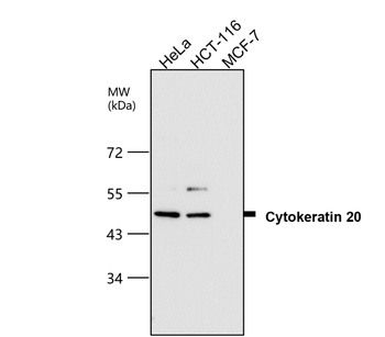 Cytokeratin 20 Rabbit Polyclonal Antibody