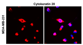Cytokeratin 20 Rabbit Polyclonal Antibody