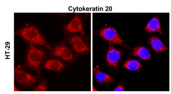Cytokeratin 20 Rabbit Polyclonal Antibody