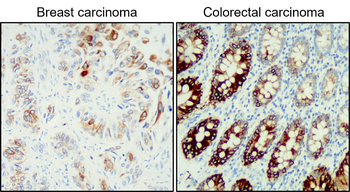 Cytokeratin 20 Rabbit Polyclonal Antibody
