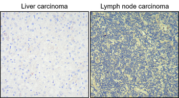 Cytokeratin 20 Rabbit Polyclonal Antibody