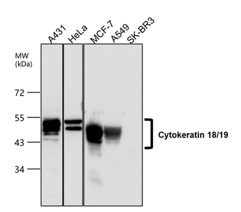Cytokeratin 18 Rabbit Polyclonal Antibody