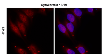 Cytokeratin 18 Rabbit Polyclonal Antibody
