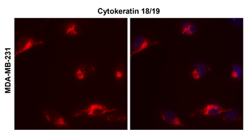 Cytokeratin 18 Rabbit Polyclonal Antibody
