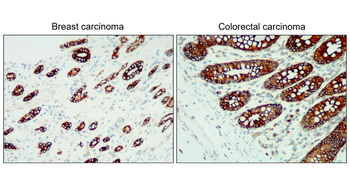 Cytokeratin 18 Rabbit Polyclonal Antibody