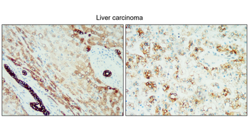 Cytokeratin 18 Rabbit Polyclonal Antibody