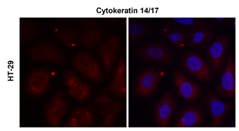 Cytokeratin 14 Rabbit Polyclonal Antibody