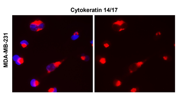 Cytokeratin 14 Rabbit Polyclonal Antibody
