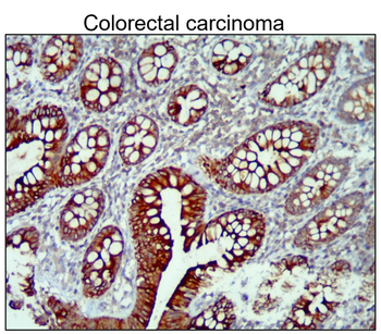 Cytokeratin 14 Rabbit Polyclonal Antibody